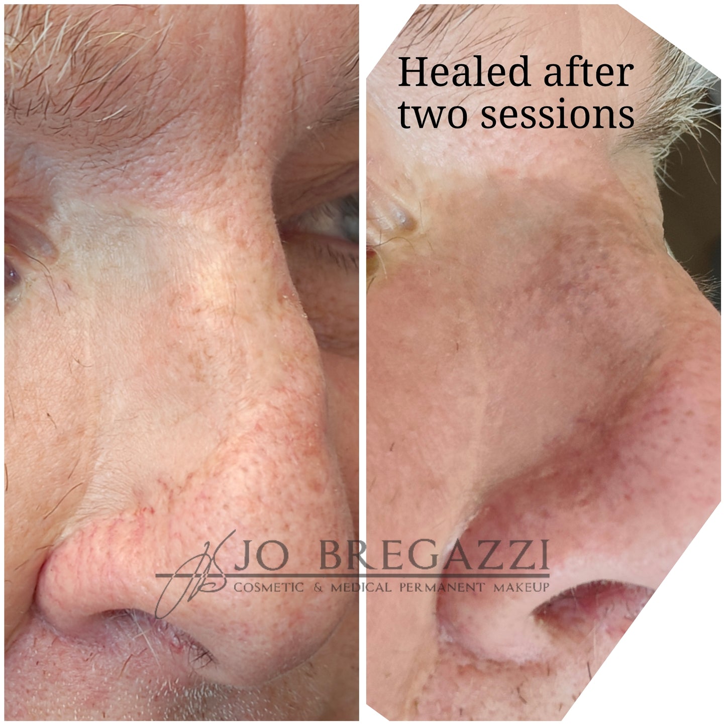 1 Day Advanced Masterclass in Scar Camouflage Techniques & Working on Damaged Skin