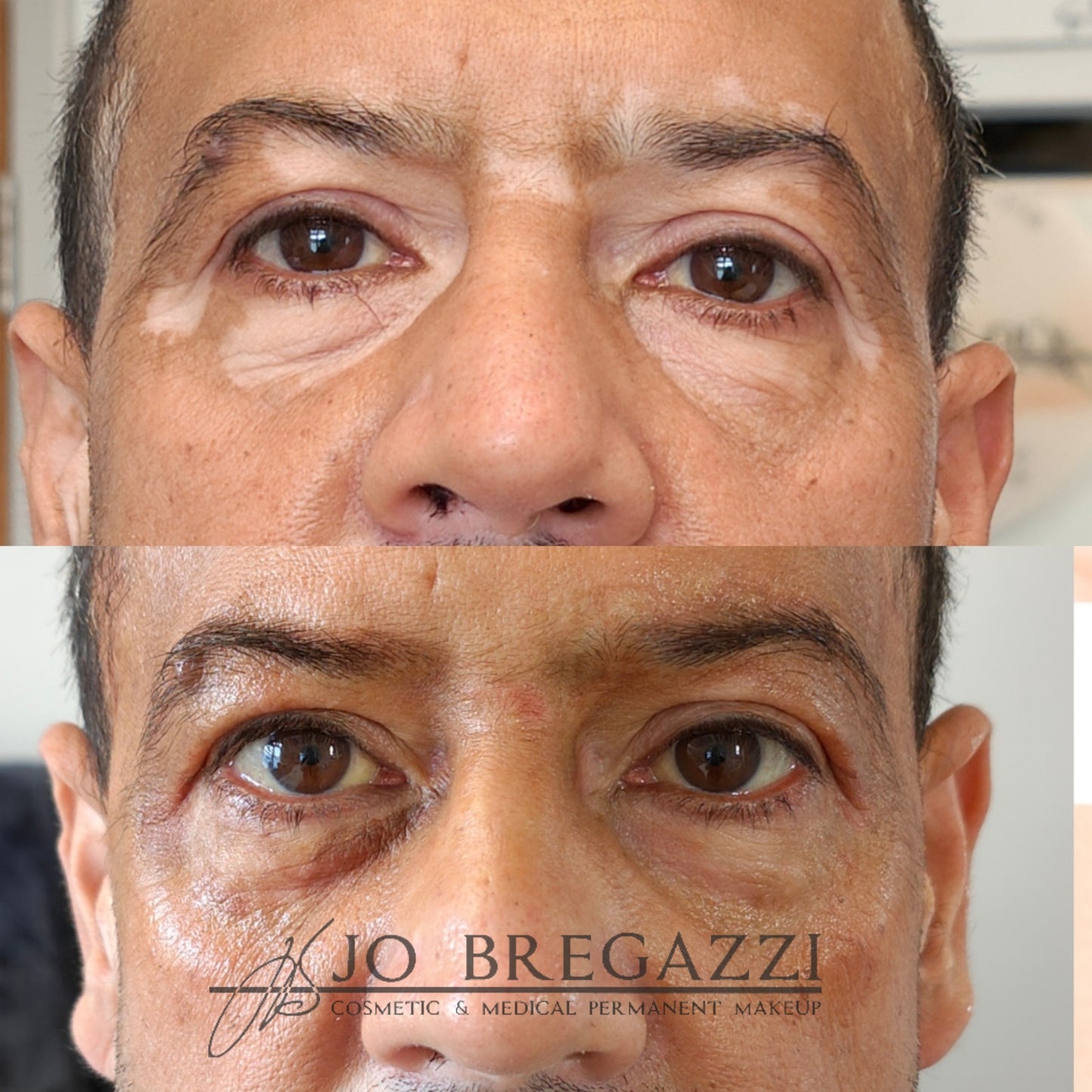 1 Day Advanced Masterclass in Scar Camouflage Techniques & Working on Damaged Skin