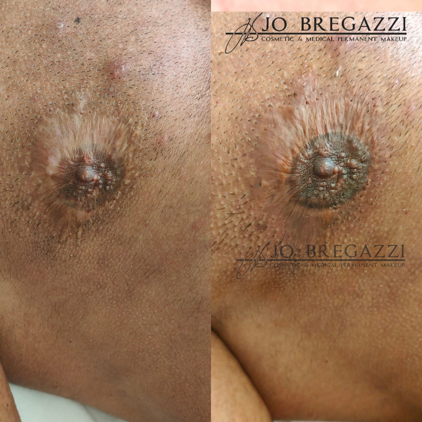 1 Day Masterclass in Advanced Colour Theory for Dark Skins Tones, Dark & Discoloured Scars
