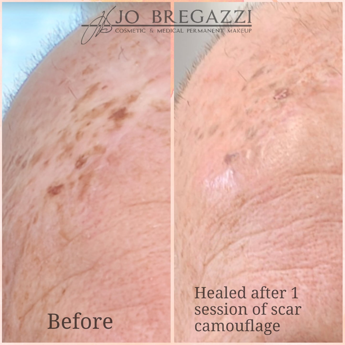 Skin, Scar and Stretchmark Camouflage : Training & Mentorship for Complete Beginners (In-person)
