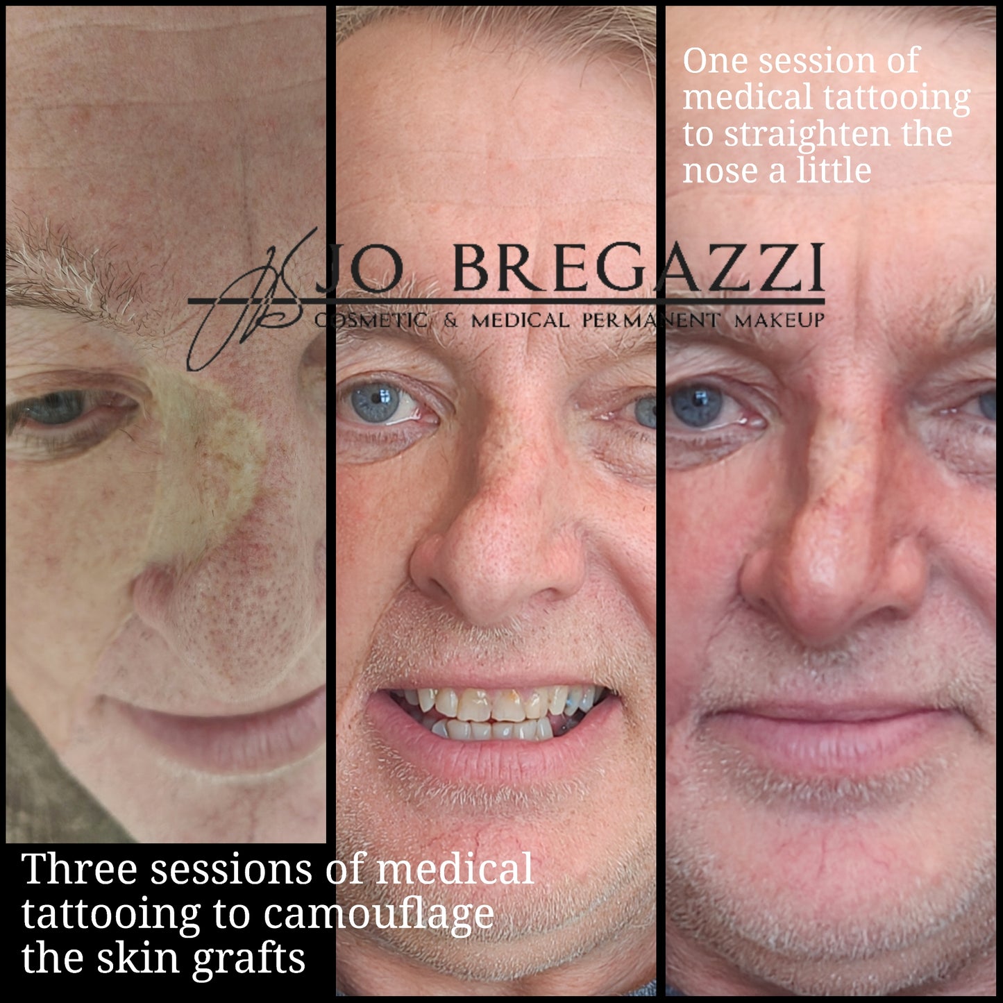Skin, Scar and Stretchmark Camouflage : Training & Mentorship for Complete Beginners (In-person)