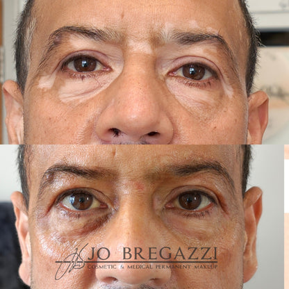 1 Day Advanced Masterclass in Scar Camouflage Techniques & Working on Damaged Skin