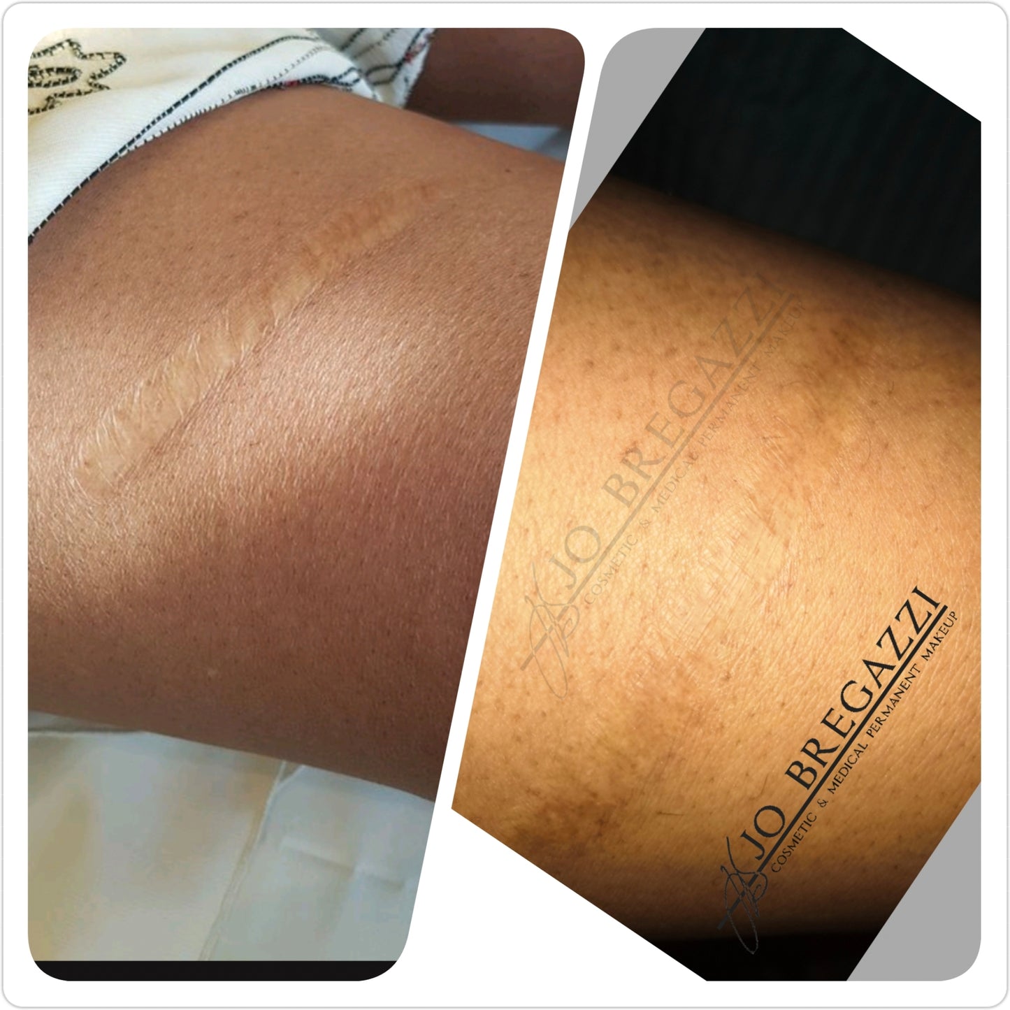 Skin, Scar and Stretchmark Camouflage : Training & Mentorship for Complete Beginners (In-person)